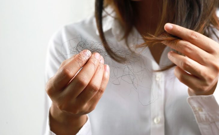 wypadanie włosów